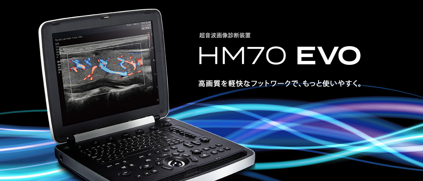 超音波画像診断装置 HM70 EVO 高画質を軽快なフットワークで、もっと使いやすく。